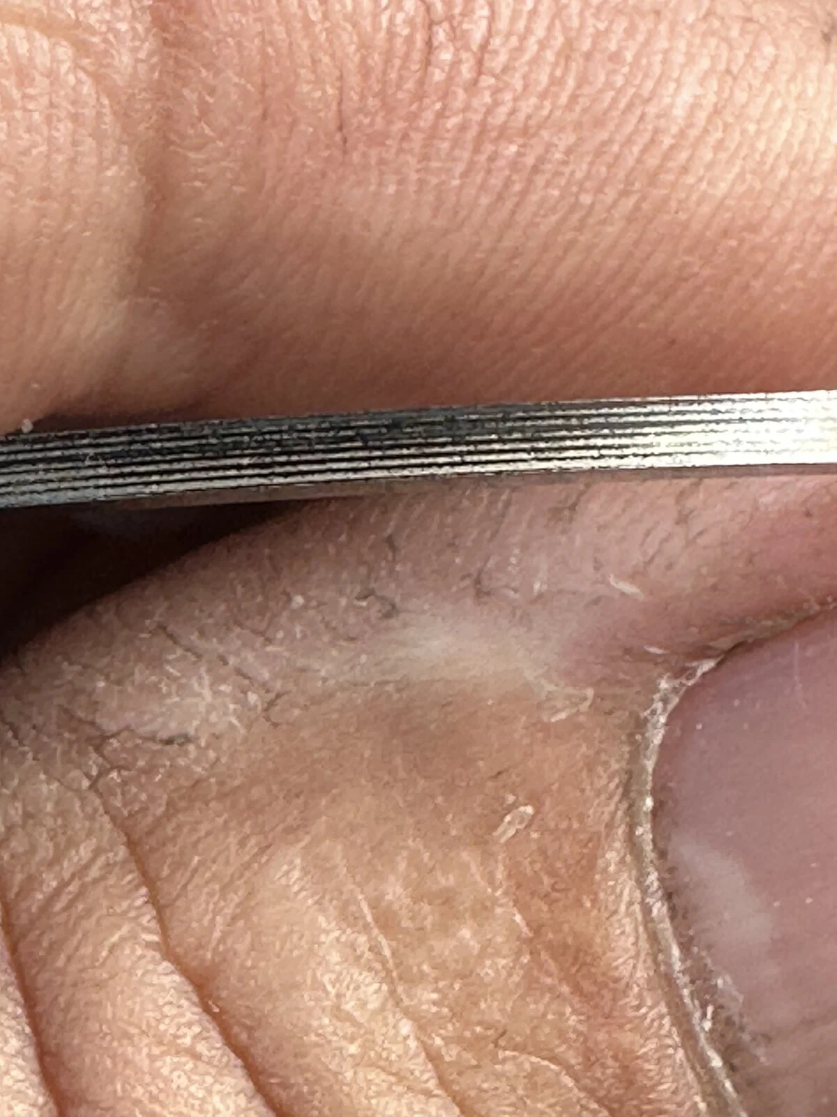 Barrell cylinder ever crack?