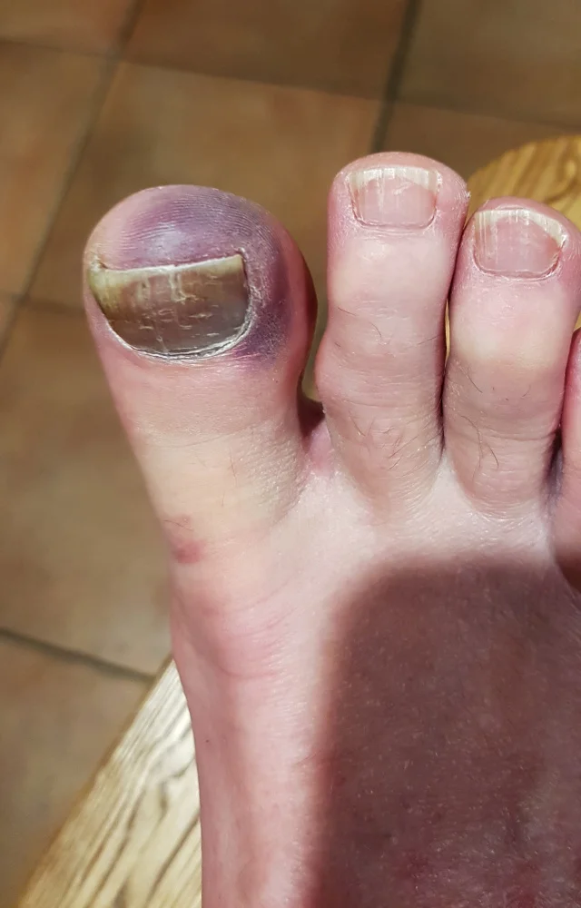 Maybe I should wear my work boots?