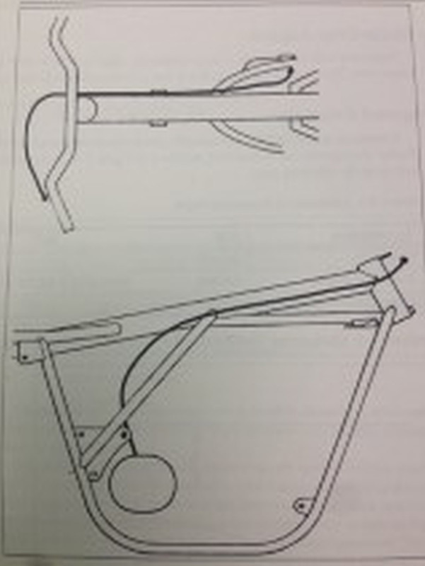 The dreaded left hand arthritis